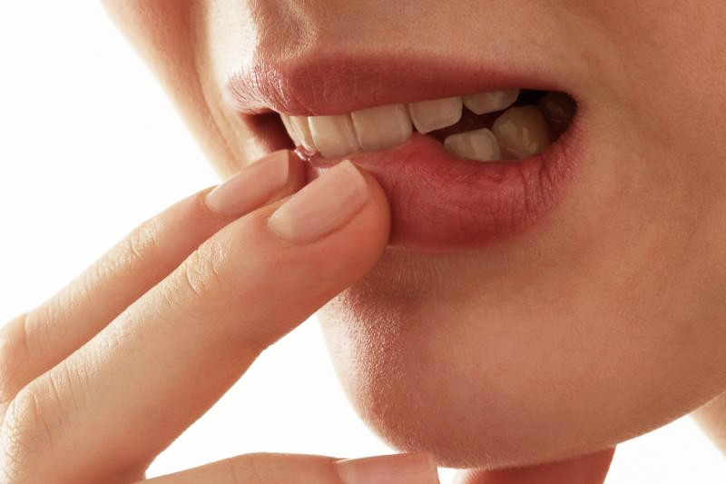 How to Get Rid of Canker Sores