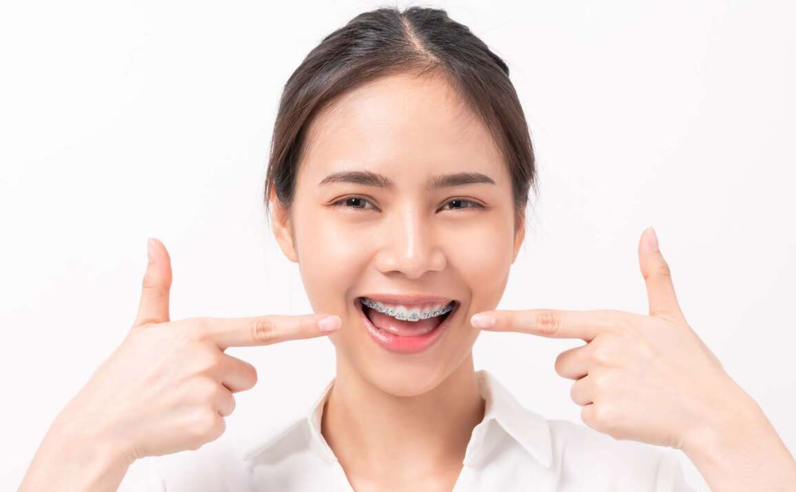 All You Need to Know About Braces and Clear Aligners