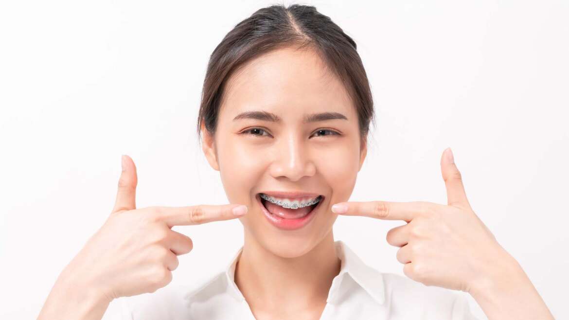 All You Need to Know About Braces and Clear Aligners