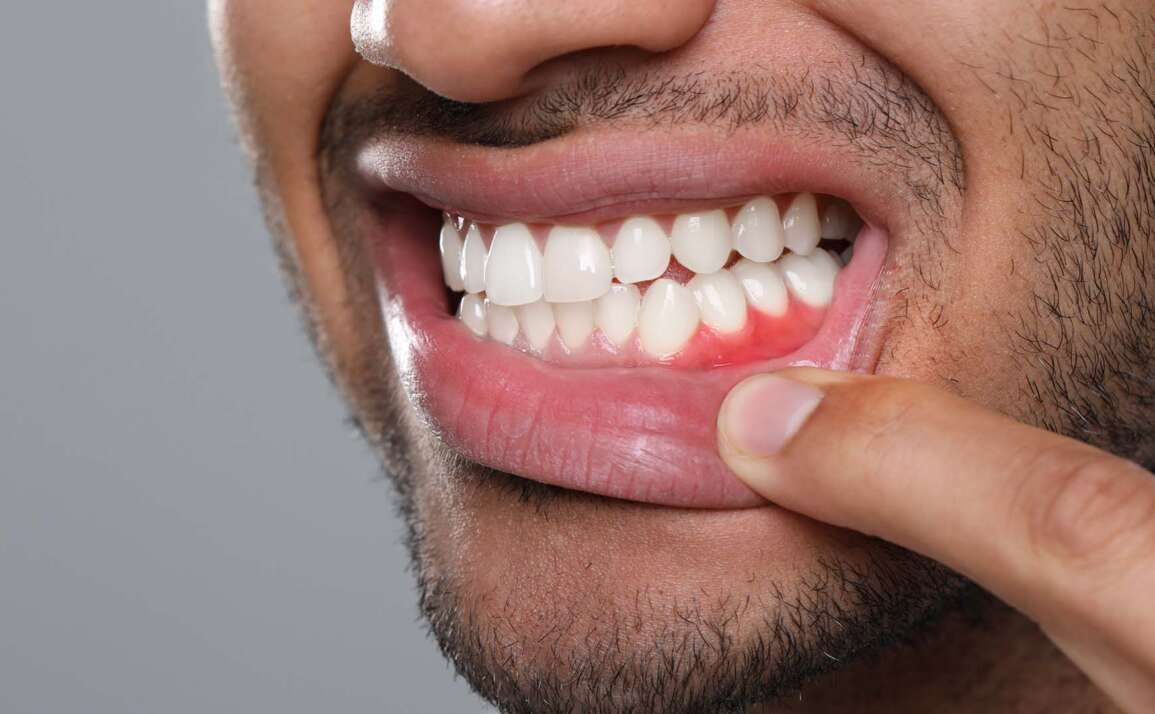 Best Treatments for Periodontal Disease | Midtown Dental Guide