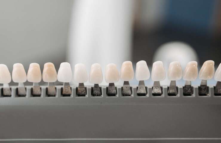 The Evolution of Cosmetic Dentistry