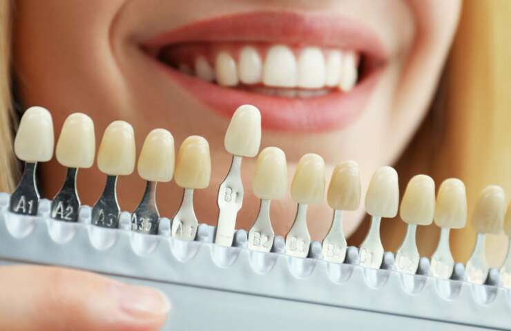 What is Cosmetic Dentistry?