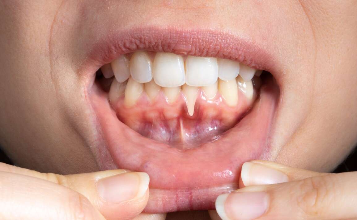 Why Gum Disease Could Be Harming Your Whole Body