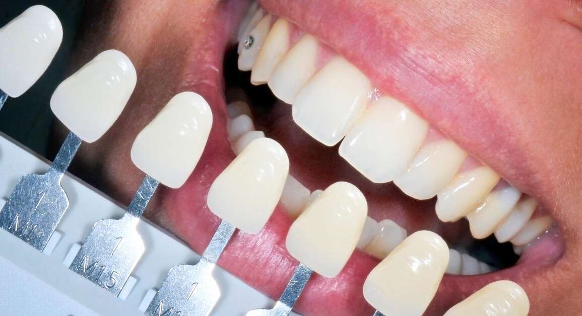 Rebuilding and Restoring Smiles with Restorative Dentistry – Midtown Dental Toronto (Midtown / Toronto)