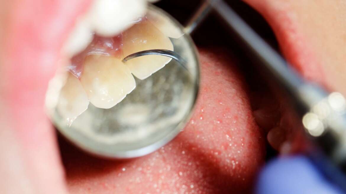 Inside a Dental Cleaning: What Really Happens – Midtown Dental Centre (Midtown / Toronto)