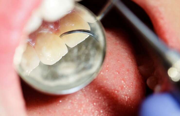 Inside a Dental Cleaning: What Really Happens – Midtown Dental Centre (Midtown / Toronto)